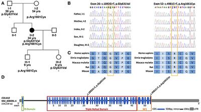 Heterozygous COL4A3 Variants in Histologically Diagnosed Focal Segmental Glomerulosclerosis